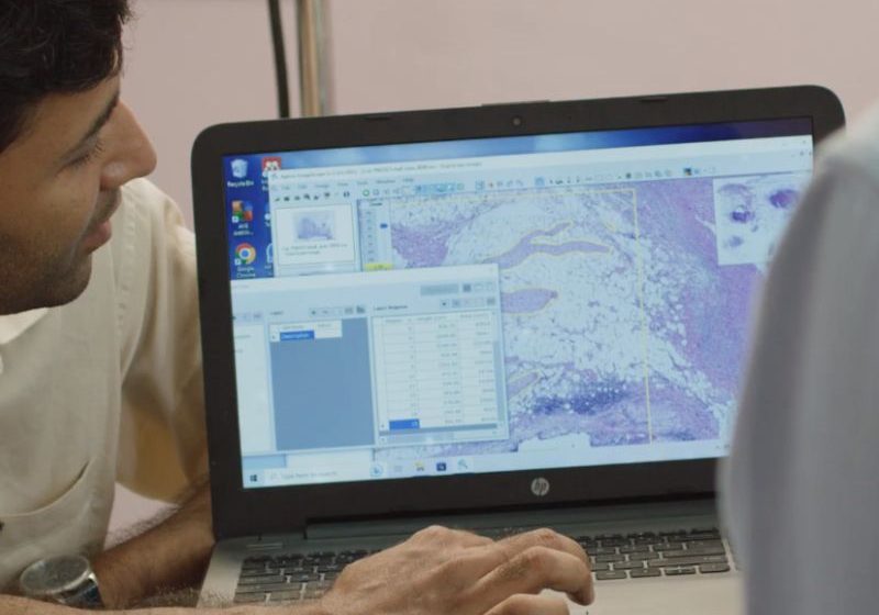  IA respaldada por Intel ayuda en la investigación contra el cáncer con alta precisión